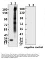 SARS-CoV-2 (COVID-19) Spike ECD Antibody