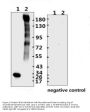 SARS-CoV-2 (COVID-19) Spike RBD Antibody