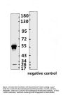 SARS-CoV-2 (COVID-19) Nucleocapsid Monoclonal Antibody [N001]