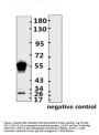 SARS-CoV-2 (COVID-19) Nucleocapsid Monoclonal Antibody [N003]