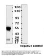 SARS-CoV-2 (COVID-19) Nucleocapsid Monoclonal Antibody [N015]