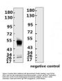 SARS-CoV-2 (COVID-19) Nucleocapsid Monoclonal Antibody [N016]