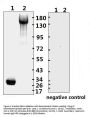 SARS-CoV-2 (COVID-19) Spike RBD Monoclonal Antibody [B001]