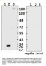 SARS-CoV-2 (COVID-19) Spike RBD Monoclonal Antibody [B002]