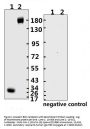SARS-CoV-2 (COVID-19) Spike RBD Monoclonal Antibody [B003]