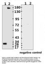 SARS-CoV-2 (COVID-19) Spike ECD Monoclonal Antibody [B004]