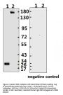 SARS-CoV-2 (COVID-19) Spike ECD Monoclonal Antibody [B004] (Biotin)