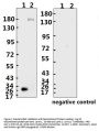 SARS-CoV-2 (COVID-19) Spike ECD Monoclonal Antibody [B005]