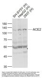 ACE2 Antibody