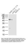SARS Nucleocapsid Antibody [5B1B]