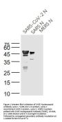 SARS Nucleocapsid Antibody [5C6C]