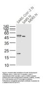 SARS Nucleocapsid Antibody [7C2B]