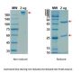 Recombinant SARS-CoV-2 (COVID-19) (S1) -2 Antibody [CR3022]