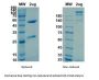 Recombinant SARS-CoV-2 (COVID-19) (S1) -1 Antibody [CR3022]