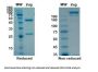 Recombinant SARS-CoV-2 (COVID-19) (S1) -3 Antibody [B38]