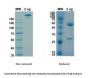 Recombinant SARS-CoV-2 (COVID-19) (S1) -4 Antibody [H4]