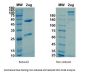 Recombinant SARS-CoV-2 (S1) -1 Neutralizing antibody Antibody