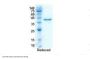 Recombinant SARS-CoV-2 RBD antibody