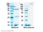 Recombinant SARS-CoV-2 RBD antibody