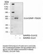 SARS-CoV-2 (COVID-19) Nucleocapsid Antibody [75G5a]