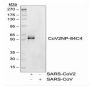 SARS-CoV-2 (COVID-19) Nucleocapsid Antibody [84C4a]