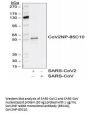 SARS-CoV-2 (COVID-19) Nucleocapsid Antibody [85C10]