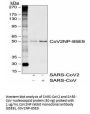 SARS-CoV-2 (COVID-19) Nucleocapsid Antibody [85E9]