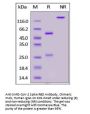 SARS-CoV-2 Spike RBD Antibody, monoclonal, Chimeric