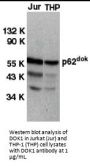DOK1 Antibody