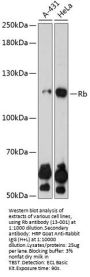 Rb Antibody