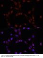 PARP1 Antibody