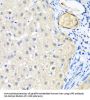 LRP5 Antibody