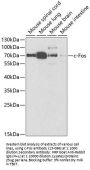 c-Fos Antibody