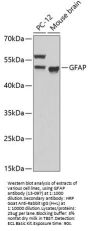 GFAP Antibody