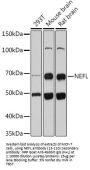 NEFL Antibody