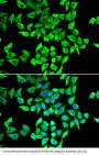 p53 Antibody