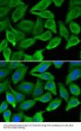 IFNA1 Antibody