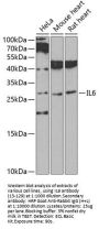IL6 Antibody