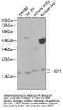 IGF1 Antibody