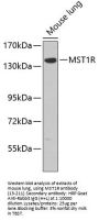 MST1R Antibody