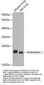 Endothelin 1 Antibody