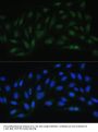 Endothelin 1 Antibody