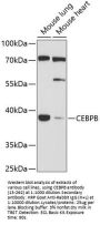 CEBPB Antibody