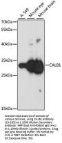CALB1 Antibody