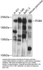ITGB4 Antibody