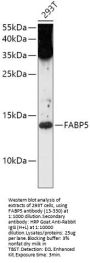 FABP5 Antibody