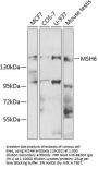 MSH6 Antibody