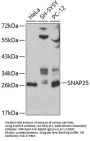SNAP25 Antibody
