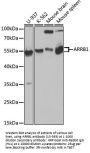 ARRB1 Antibody