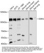 DDR2 Antibody